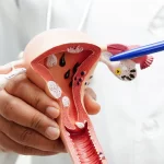 Self-Collection HPV Testing