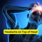 Headache on Top of Head