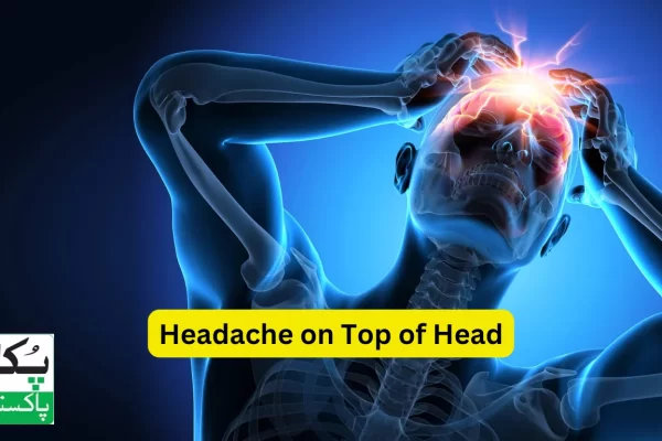 Headache on Top of Head