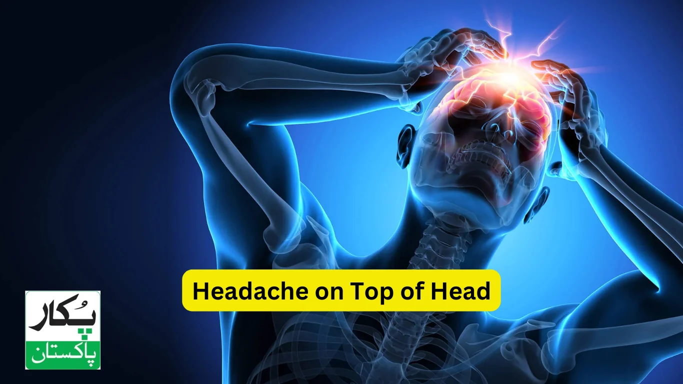 Headache on Top of Head